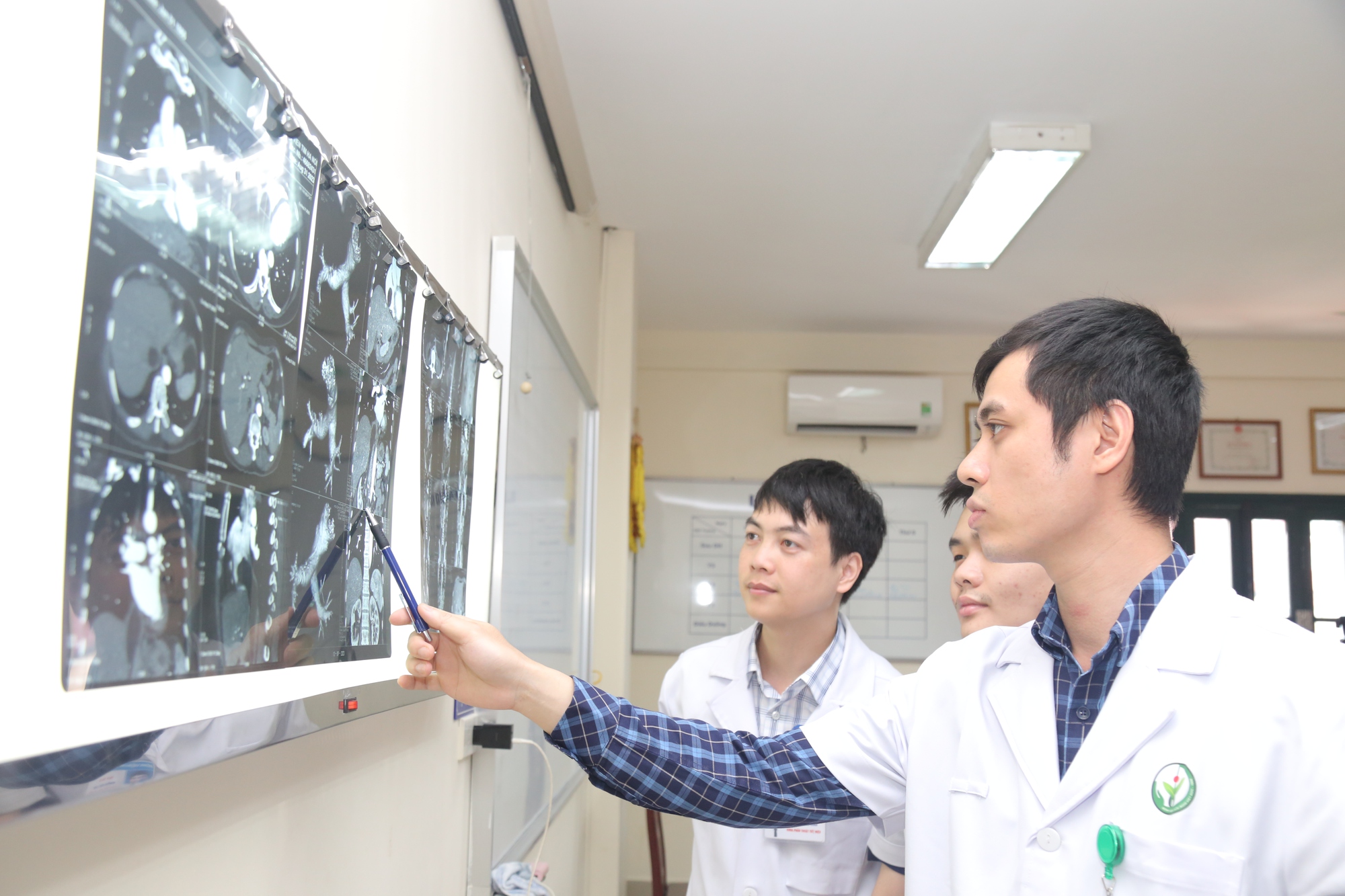Lần đầu tiên tại Việt Nam phẫu thuật u cơ mỡ mạch thận lan lên đến tim   - Ảnh 2.
