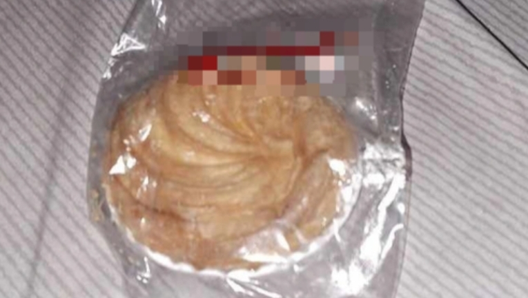Thêm 19 người nhập viện nghi ngộ độc sau ăn bánh Trung thu  - Ảnh 2.
