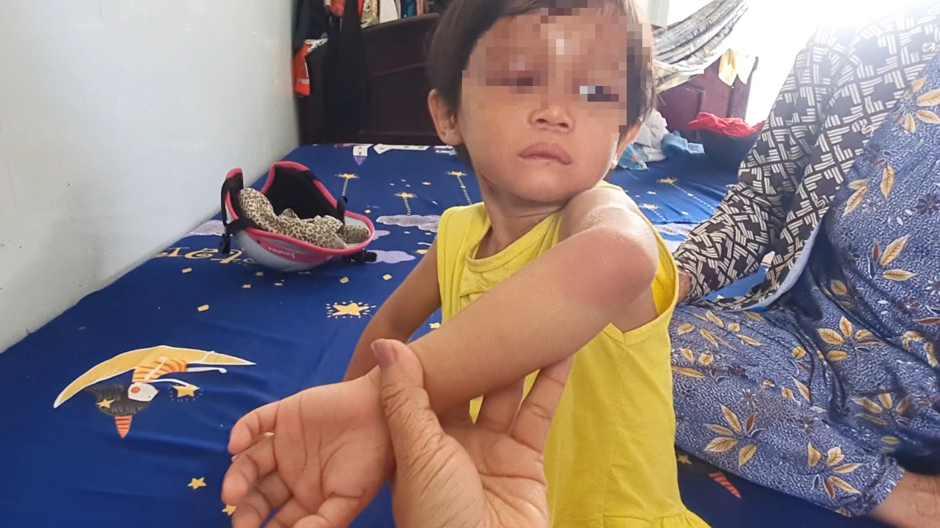 Vụ bé gái 4 tuổi ở Cà Mau nghi bị đánh đập: Cha nuôi nhiều lần đánh con - Ảnh 1.