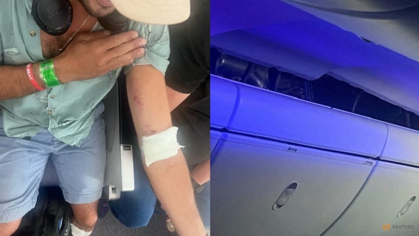 Hành khách bị thương trong chuyến bay của LATAM Airlines từ Sydney tới Auckland ngày 11/3, trong khi trần máy bay bị hư hại sau vụ việc. (Ảnh: Reuters)