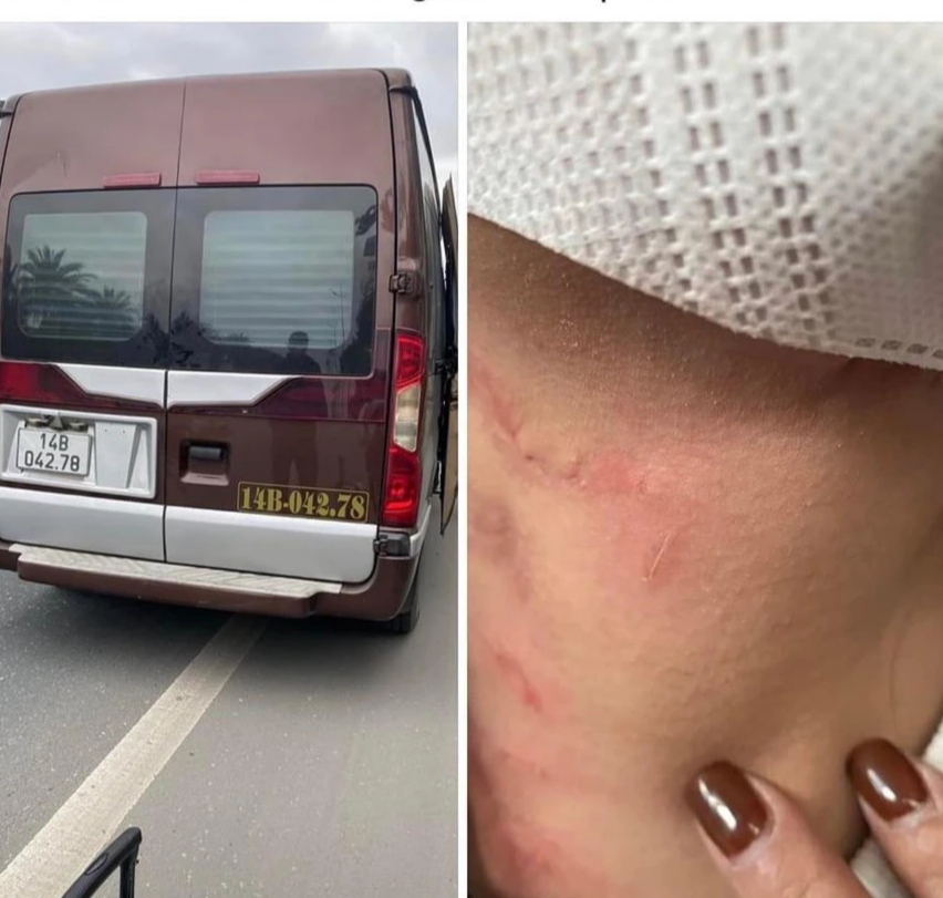 Vụ nữ hành khách tố bị phụ xe bóp cổ: Xử phạt chủ xe limousine chạy dù- Ảnh 1.
