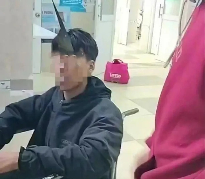 Múa dao biểu diễn, thiếu niên ở Lâm Đồng bị dao bầu cắm hốc mắt- Ảnh 1.