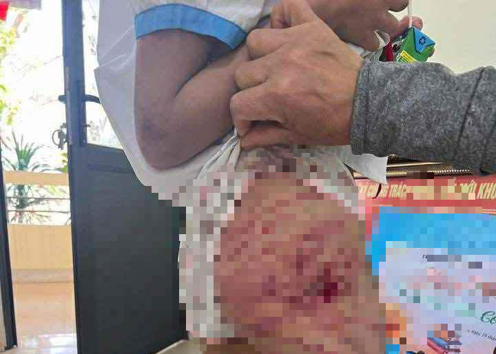 Hà Tĩnh: Xác minh vụ bé gái lớp 5 nghi bị cha dượng bạo hành- Ảnh 1. Hà Tĩnh: Xác minh vụ bé gái lớp 5 nghi bị cha dượng bạo hành- Ảnh 1.