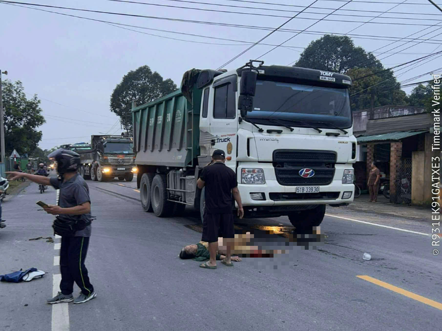 TP.HCM: Xe ben tông xe máy, cán nát một chân người phụ nữ- Ảnh 1. TP.HCM: Xe ben tông xe máy, cán nát một chân người phụ nữ- Ảnh 1.