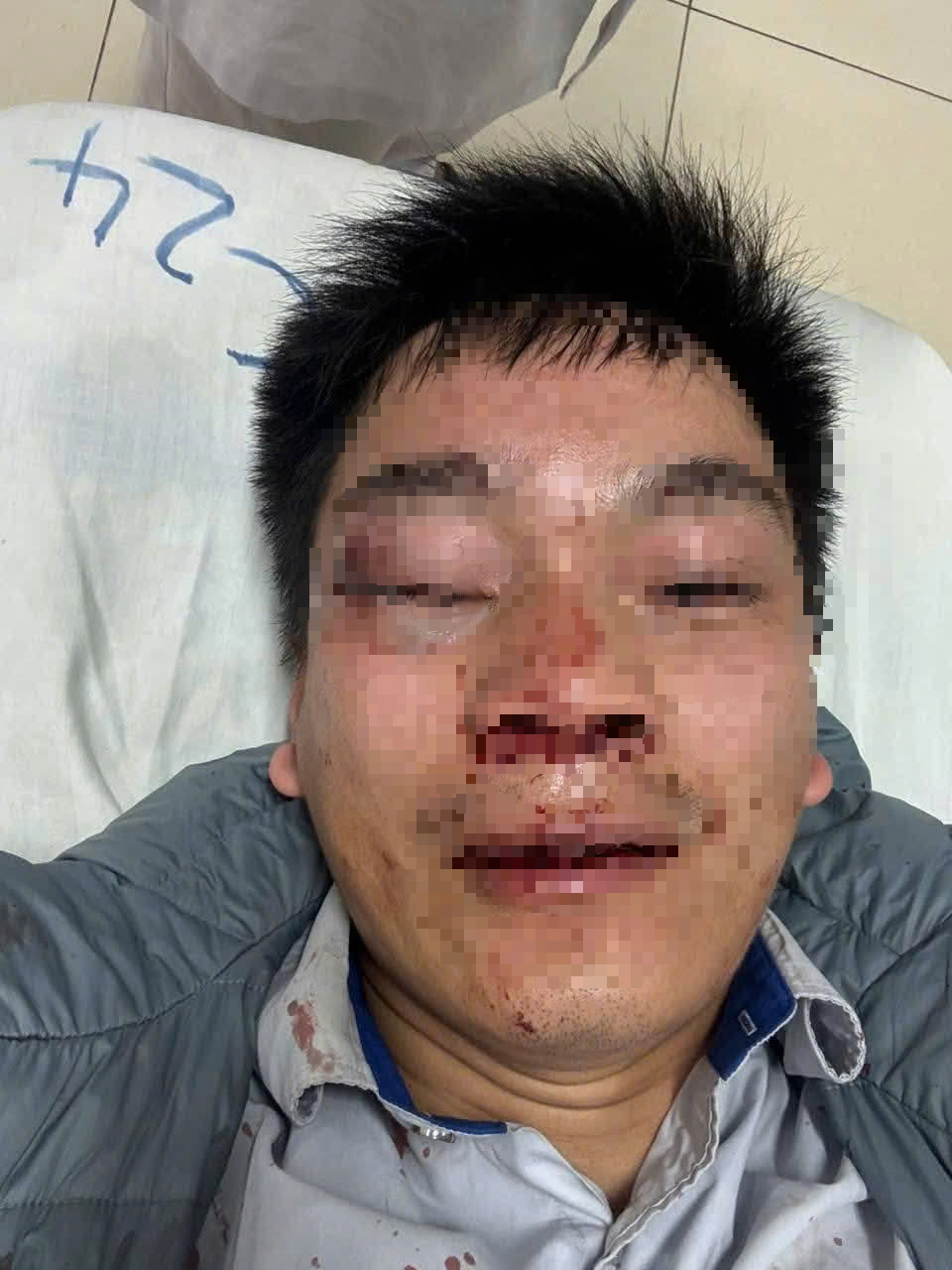 Va chạm khi dừng đón khách, lái xe buýt bị hành hung phải nhập viện- Ảnh 1. Va chạm khi dừng đón khách, lái xe buýt bị hành hung phải nhập viện- Ảnh 1.