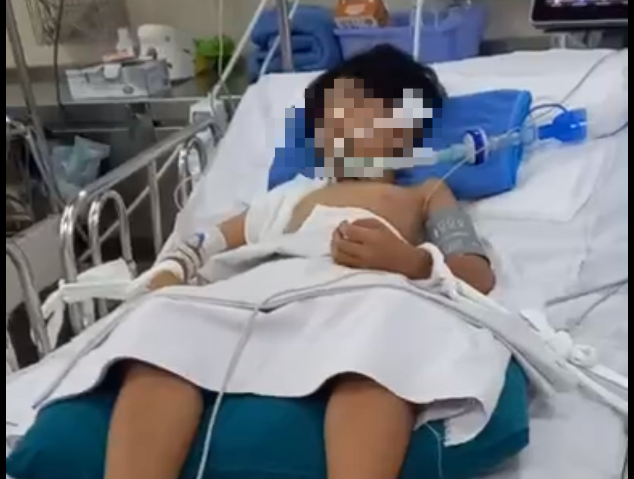 Bị nhánh cây rơi trúng đầu khi đang chờ đèn đỏ, bé trai 10 tuổi ở TP.HCM nguy kịch- Ảnh 1. Bị nhánh cây rơi trúng đầu khi đang chờ đèn đỏ, bé trai 10 tuổi ở TP.HCM nguy kịch- Ảnh 1.