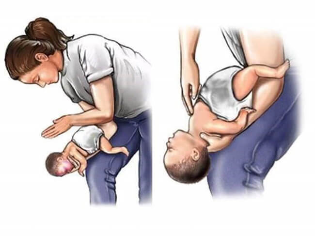 Trẻ hóc hạt nhãn, hạt na, cha mẹ lưu ý điều này để cứu con- Ảnh 2. Trẻ hóc hạt nhãn, hạt na, cha mẹ lưu ý điều này để cứu con- Ảnh 2.