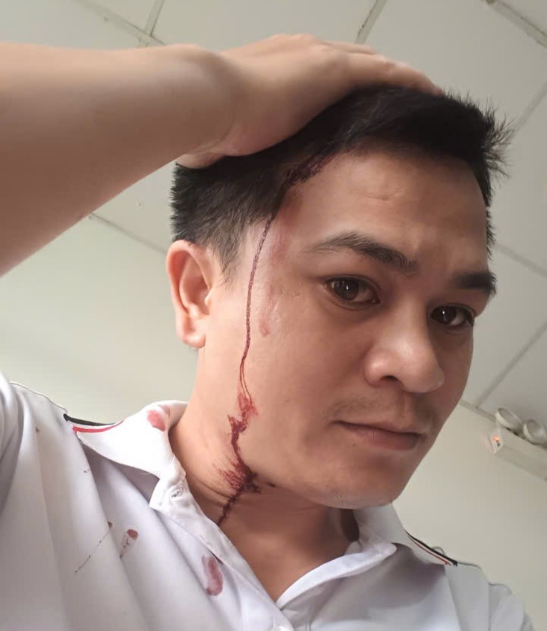 Người đàn ông ở TP.HCM bị người lạ tấn công giữa đường phải nhập viện- Ảnh 1.