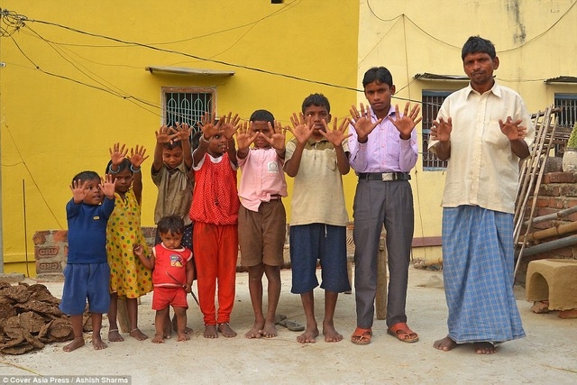Mỗi người trong gia đình Choudhary đều có 12 ngón 