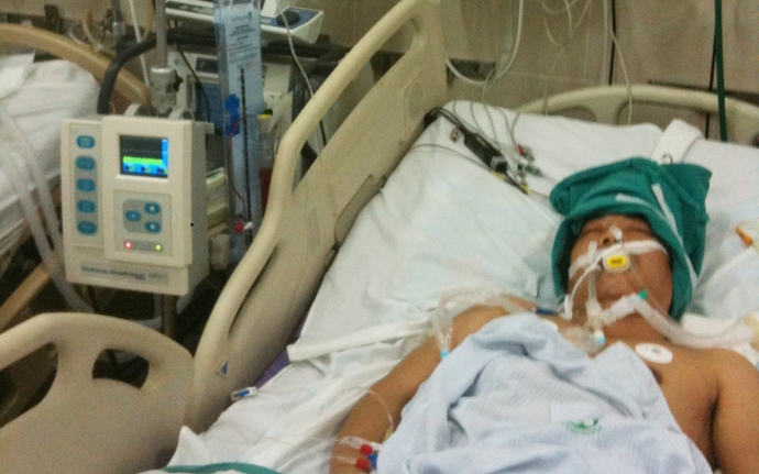 Một bệnh nhân đột quỵ điều trị tại BV Bạch mai