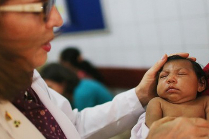 1Virus Zika gây ra dị tật đầu nhỏ đối với trẻ sơ s