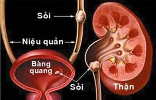 soi nieu quan