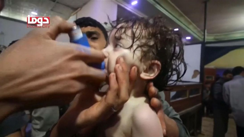 syria-chemical-attack-child_4277057