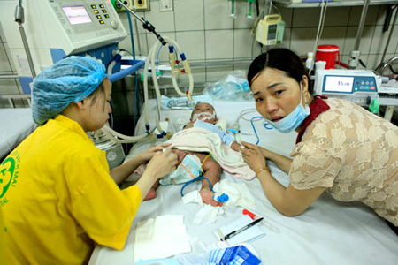Trẻ bị sởi biến chứng đang điều trị tại Khoa Nhi, Bệnh viện Bạch Mai