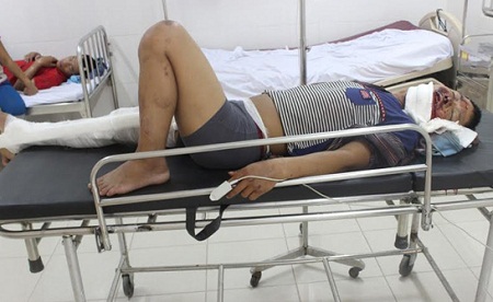 Các công nhân bị thương được chuyển ra Hà Nội điều trị