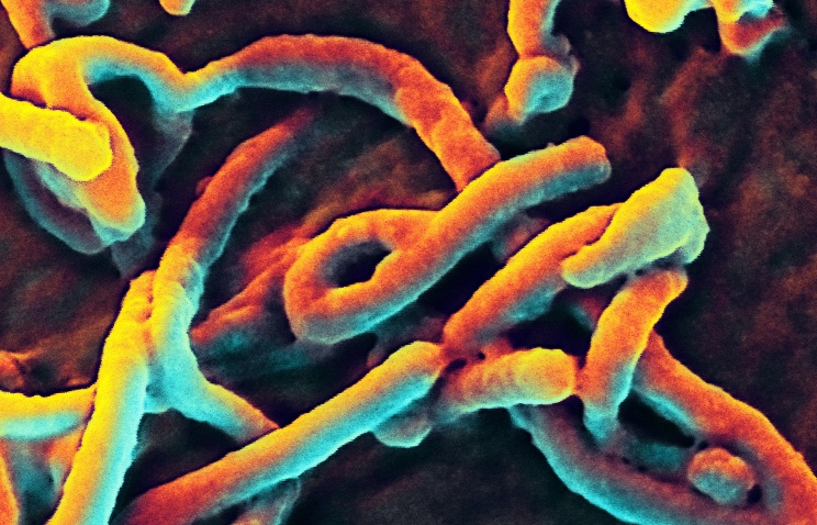 Virus Ebola qua kính hiển vi