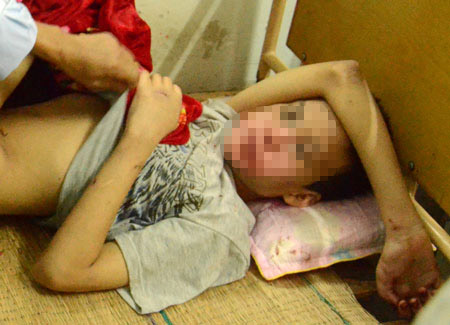  Bé trai khuyết tật 14 tuổi ở Nghệ An bị hàng xóm xâm hại dã man