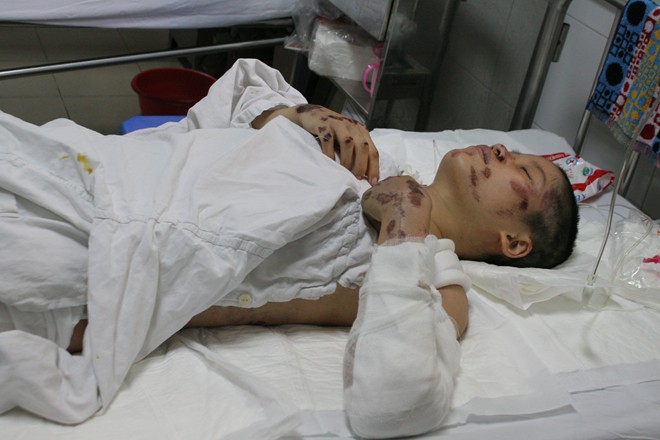 Chị Ngà được chuyển cấp cứu bệnh viện Việt Đức trong tình trạng rất nặng (Ảnh: Thanh Tuyền/Zing News)