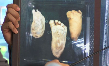 Tang vật vụ án - một trong những hộp nhựa chứa bộ phận cơ thể người