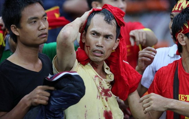 CĐV Việt Nam bị hành hung dẫn đến đổ máu