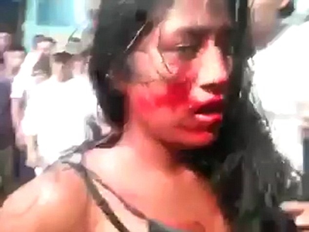 cô gái trẻ bị đánh liên tiếp vào mặt, khiến khuôn 