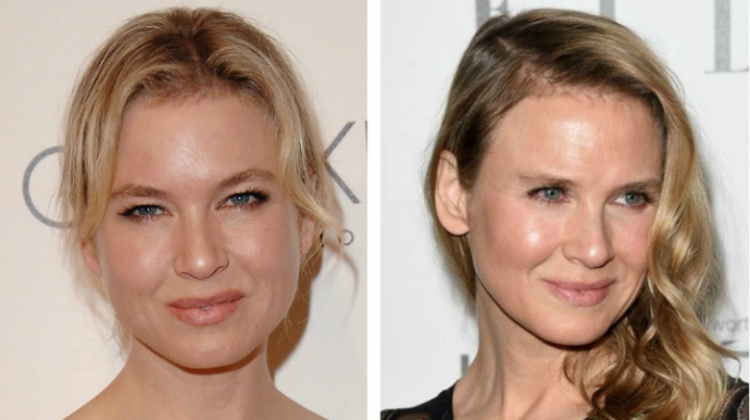 renee-zellweger-phau-thuat-tham-my-tgvh