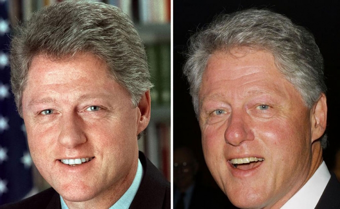 Đôi mắt của Tổng thống Bill Clinton trũng