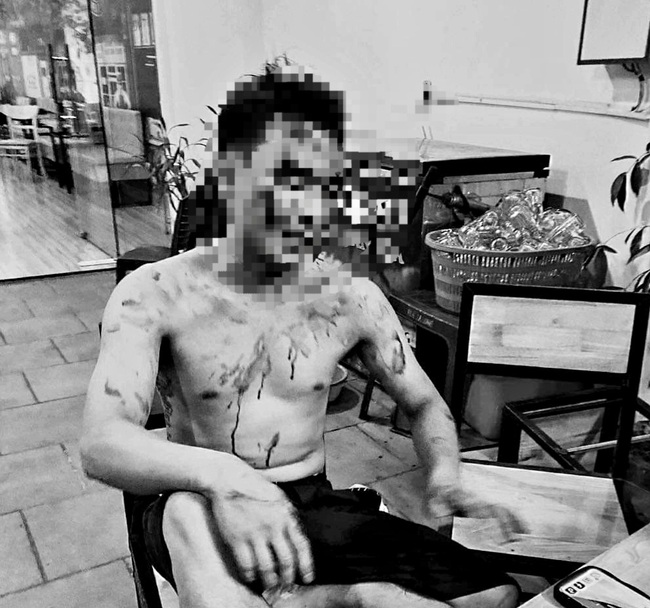 Hải Dương: Nam thanh niên bị đánh nhập viện khi đang ngồi trong phòng trà 
- Ảnh 1.