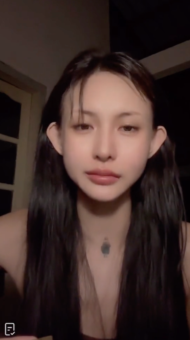 Người mẫu Lâm Minh lên tiếng giải thích lý do mồm chảy máu, ôm con khóc lóc nửa đêm- Ảnh 1.