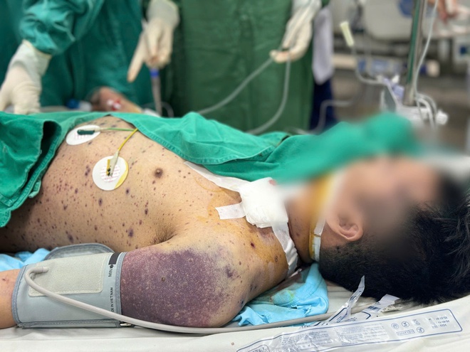 Bội nhiễm do bệnh thủy đậu "đốn ngã" thanh niên khỏe mạnh- Ảnh 2. Bội nhiễm do bệnh thủy đậu "đốn ngã" thanh niên khỏe mạnh- Ảnh 2.