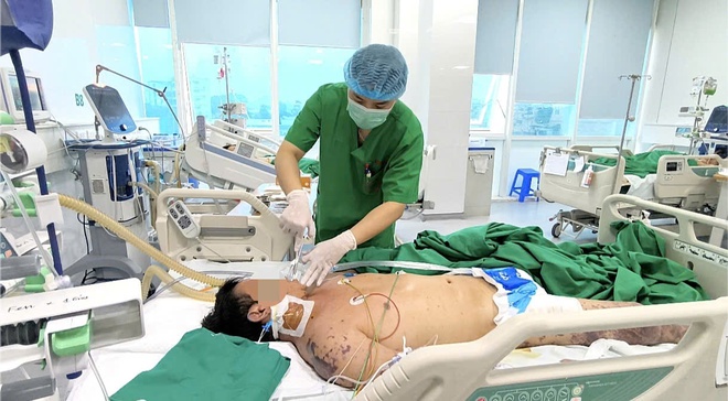 Người đ&agrave;n &ocirc;ng nguy kịch v&igrave; vi khuẩn n&atilde;o m&ocirc; cầu sau đ&aacute;m cỗ- Ảnh 1.