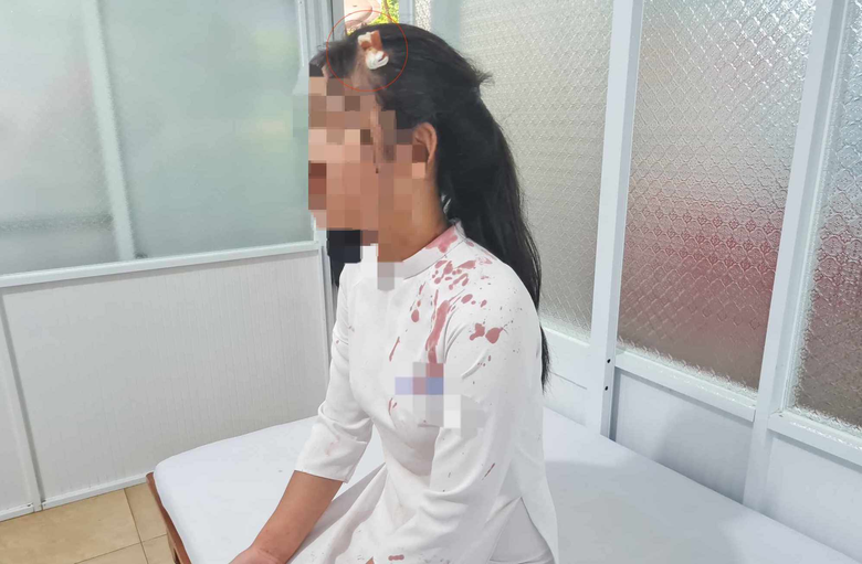 Nữ sinh lớp 10 bị bạn c&ugrave;ng lớp d&ugrave;ng guốc đ&aacute;nh bể đầu, kh&acirc;u bốn mũi - Ảnh 1.