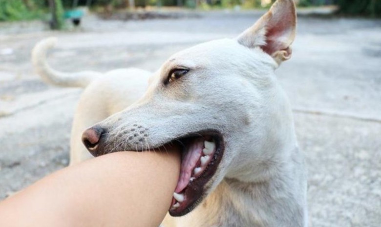 B&eacute; trai 6 tuổi nhập viện v&igrave; vết thương ch&oacute; cắn 1 th&aacute;ng kh&ocirc;ng l&agrave;nh   - Ảnh 1.