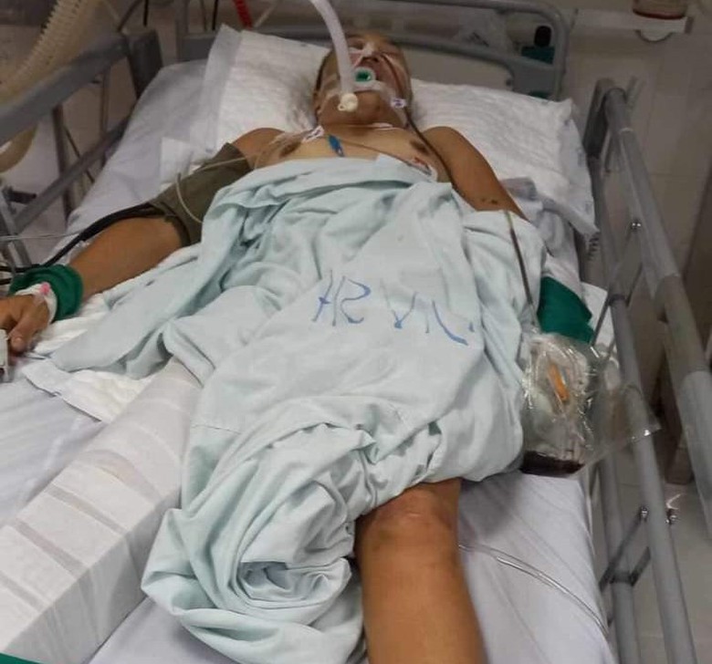 Một m&igrave;nh nu&ocirc;i 3 con nhỏ sau ly h&ocirc;n, người phụ nữ lại bị tai nạn nguy kịch - Ảnh 1.