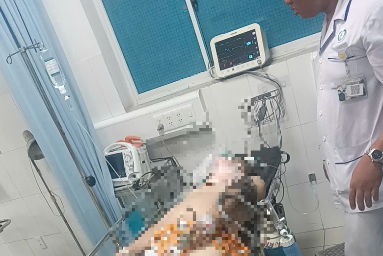 Xe m&aacute;y vỡ vụn sau c&uacute; t&ocirc;ng trực diện v&agrave;o xe tải- Ảnh 2.