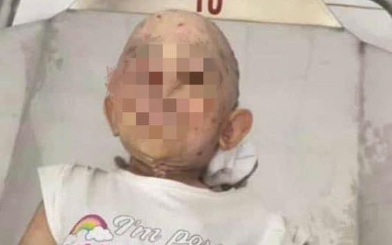 Điều tra nguy&ecirc;n nh&acirc;n b&eacute; g&aacute;i 5 tuổi tử vong nghi bị bạo h&agrave;nh