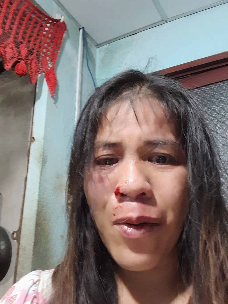 Long An: Chủ tịch x&atilde; đ&aacute;nh vợ t&iacute;m mặt, Ủy ban Kiểm tra huyện ủy v&agrave;o cuộc- Ảnh 1.