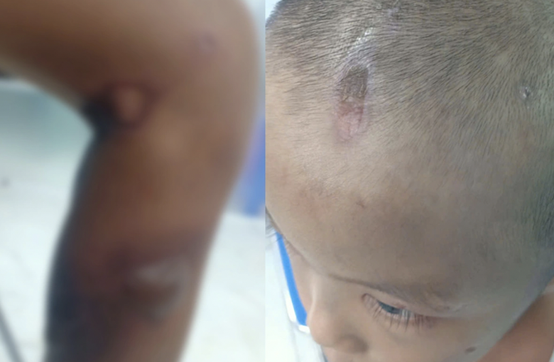 Bắt người đ&agrave;n &ocirc;ng c&ugrave;ng vợ hờ nghi bạo h&agrave;nh con ruột- Ảnh 1.