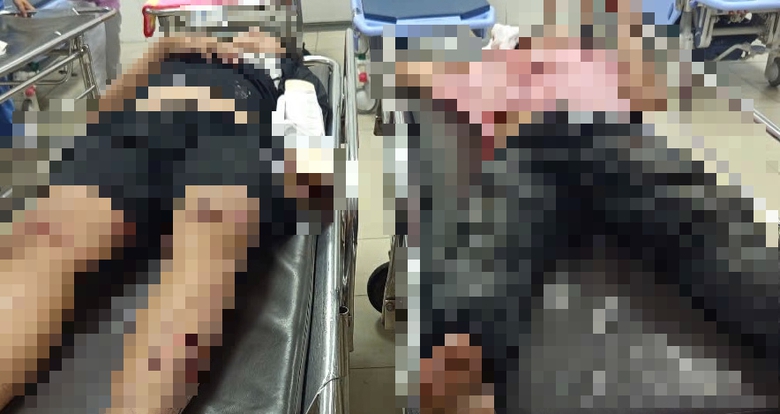 Hai xe m&aacute;y va chạm trong khu c&ocirc;ng nghiệp, hai người trọng thương- Ảnh 3.