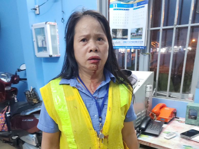 Nữ nh&acirc;n vi&ecirc;n g&aacute;c t&agrave;u bị h&agrave;nh hung: Đối tượng nồng nặc m&ugrave;i rượu- Ảnh 3.