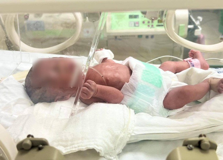 B&aacute;c sĩ 2 bệnh viện c&acirc;n n&atilde;o mổ lấy thai cho sản phụ mắc bệnh tim nặng- Ảnh 2.