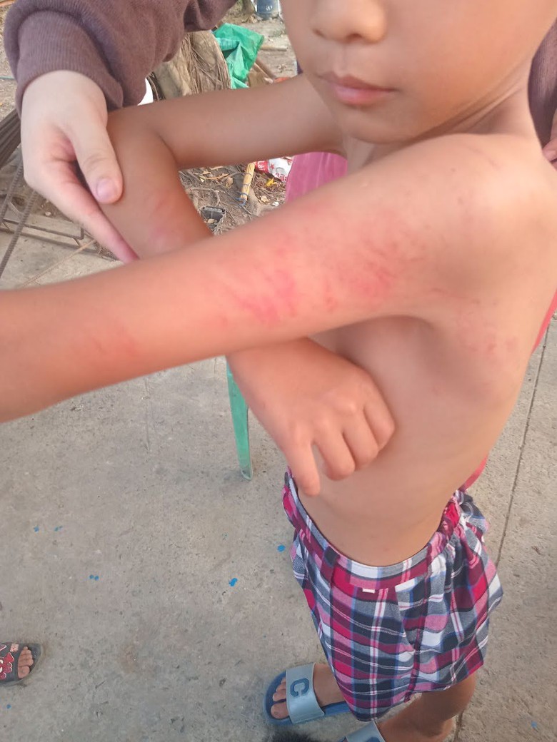 C&ocirc; gi&aacute;o đ&aacute;nh học sinh ở Long An bị kỷ luật, chuyển trường- Ảnh 1.