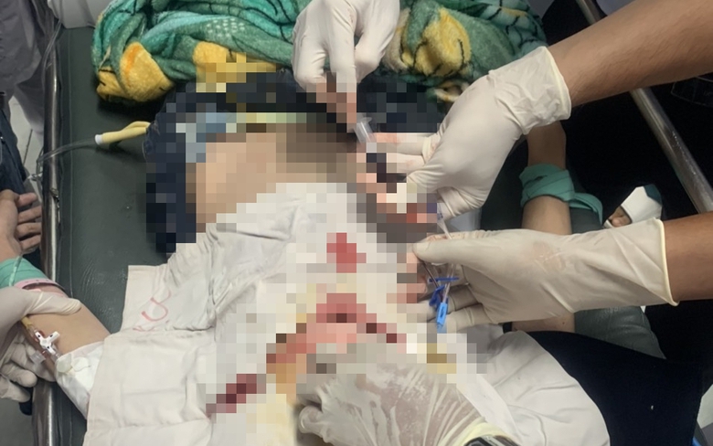 Xe m&aacute;y va chạm xe ba g&aacute;c, một người bị thương rất nặng