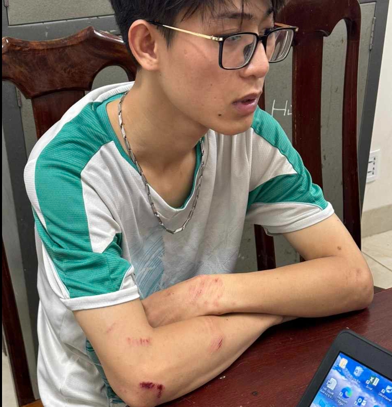 Chỉ v&igrave; 300 ng&agrave;n đồng, con nợ s&aacute;t hại bạn chủ nợ- Ảnh 1.