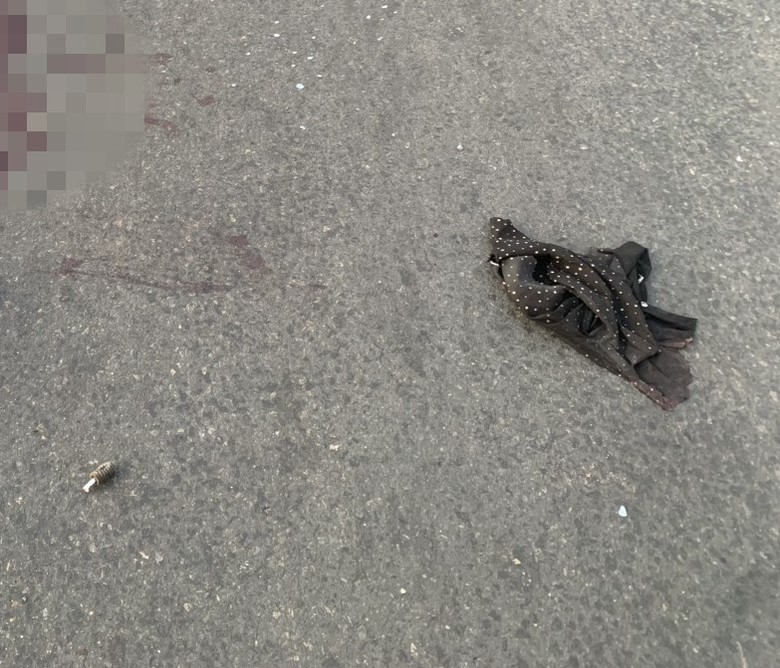 Người đ&agrave;n &ocirc;ng bị kẻ lạ mặt đuổi theo, đ&acirc;m trọng thương giữa đường- Ảnh 1.