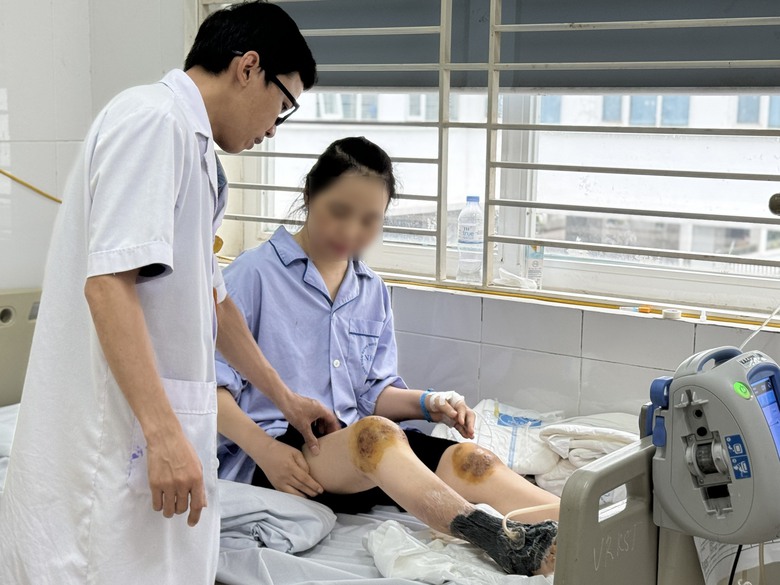 Để ong ch&acirc;m khớp gối chữa bệnh, một phụ nữ nguy kịch- Ảnh 1.