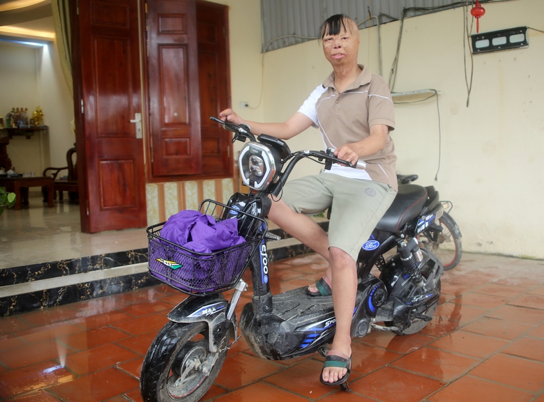 B&eacute; trai 3 tuổi bị bố ruột tẩm xăng đốt giờ ra sao?- Ảnh 2.