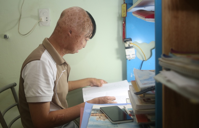 B&eacute; trai 3 tuổi bị bố ruột tẩm xăng đốt giờ ra sao?- Ảnh 3.