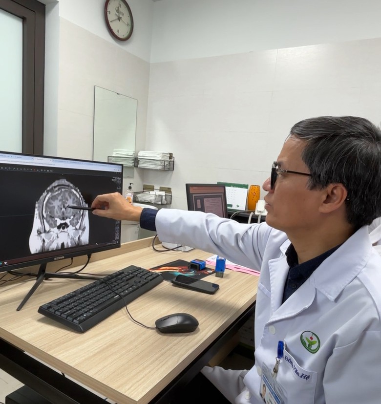 Kỳ diệu ca phẫu thuật giải tho&aacute;t đớn đau cho ch&agrave;ng trai 21 năm động kinh- Ảnh 2.