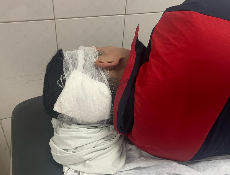 X&aacute;c minh t&agrave;i xế taxi bị đ&aacute;nh nhập viện trước văn ph&ograve;ng xe kh&aacute;ch- Ảnh 1.